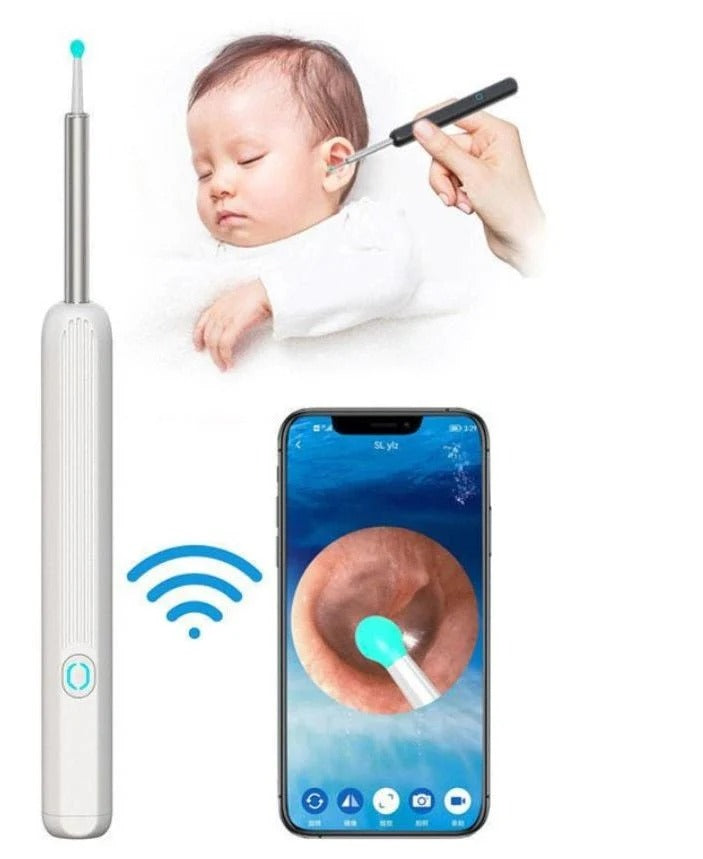 Professional Ear Wax Removal Kit – Safe & Reusable Ear Cleaner Tool Set